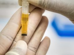 Does CBD Show Up On A Drug Test? What You Need to Know 2022