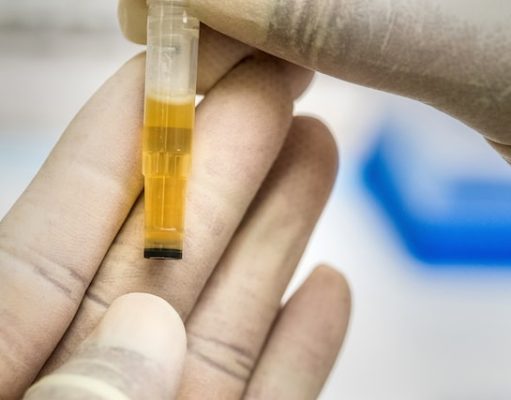 Does CBD Show Up On A Drug Test? What You Need to Know 2022
