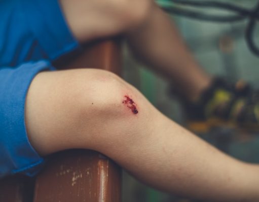Injured on Holiday in Australia: Here’s How a Skilled Lawyer Can Help You