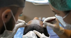 What Does a Hair Transplant Look Like After 1 Year?